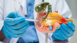 Анатомическая модель желчного пузыря в руках врача в перчатках с указкой; иллюстрация для ролика о функциях, перегибе, взвеси и удалении желчного пузыря