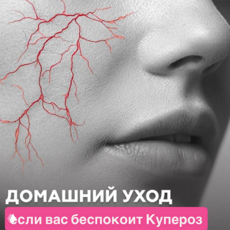 Купероз: шпаргалка для домашнего ухода