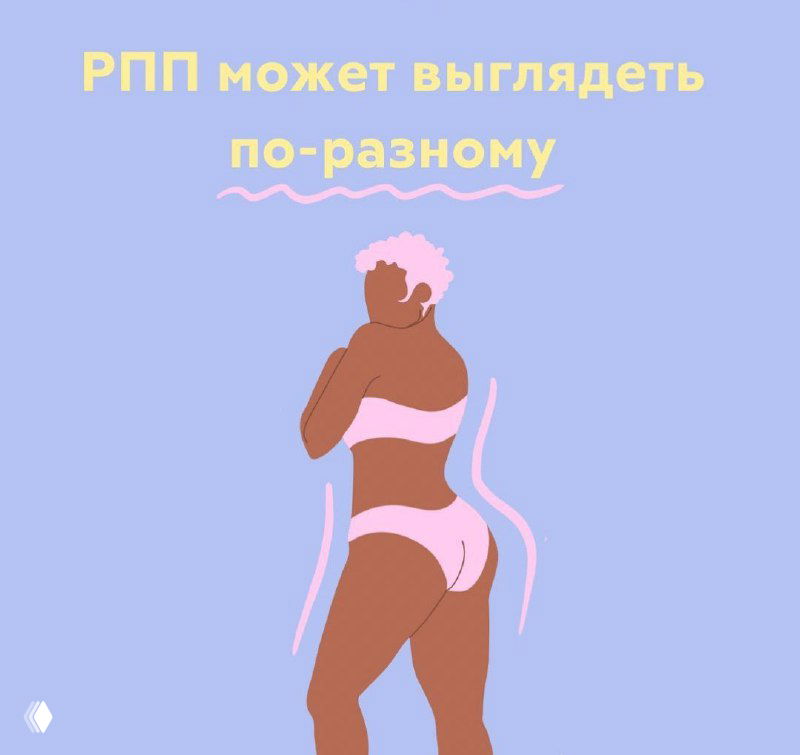 РПП может выглядеть по‑разному