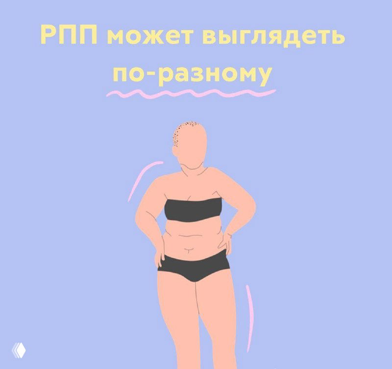 Иллюстрация женщины в чёрном бикини с видимыми чертами лишнего веса и подписью «РПП может выглядеть по‑разному», демонстрация, что внешний вид не равен диагнозу.