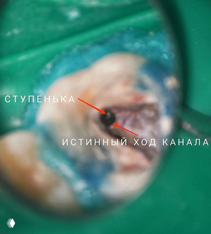 Золотое правило поиска каналов в микроскоп