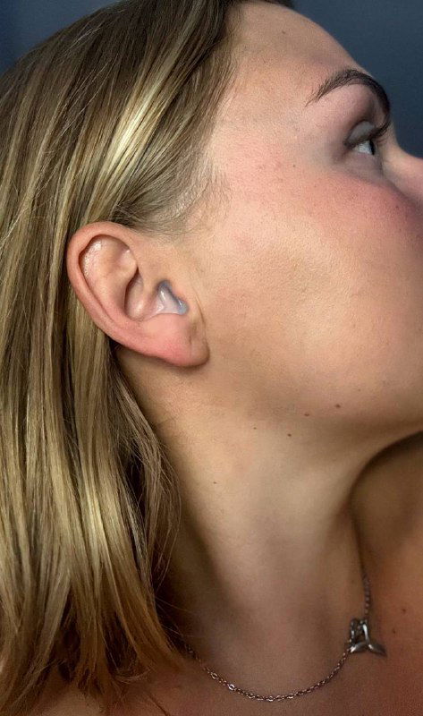 Женское ухо с вставленной индивидуальной берушей — показано, как изделие сидит в слуховом проходе и выглядит при носке