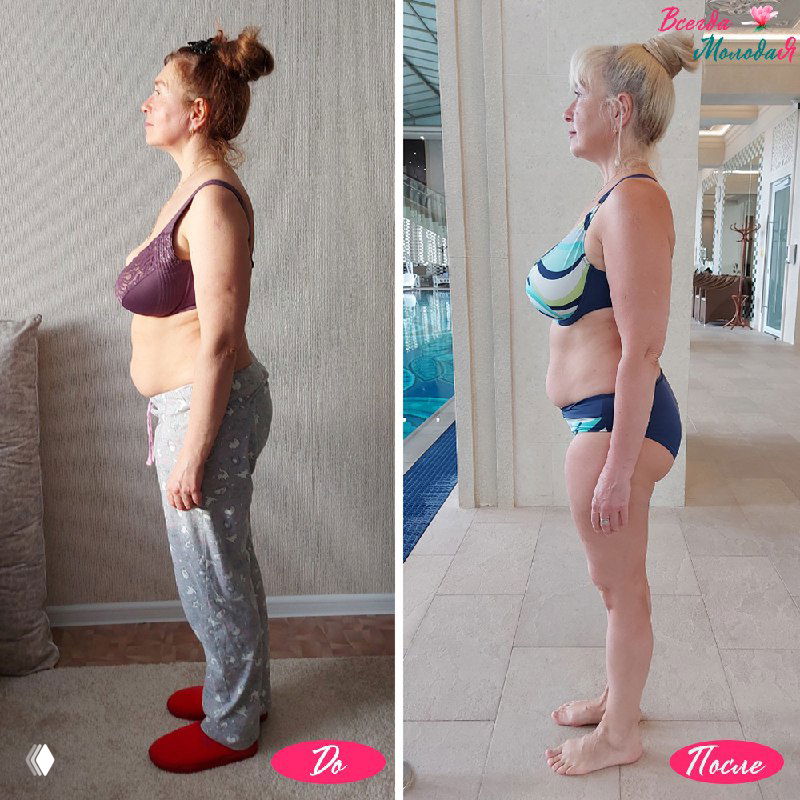 Боковые фото «до и после»: профиль женщины, видна улучшенная осанка, подтянутый живот и более вытянутая шея после занятий.