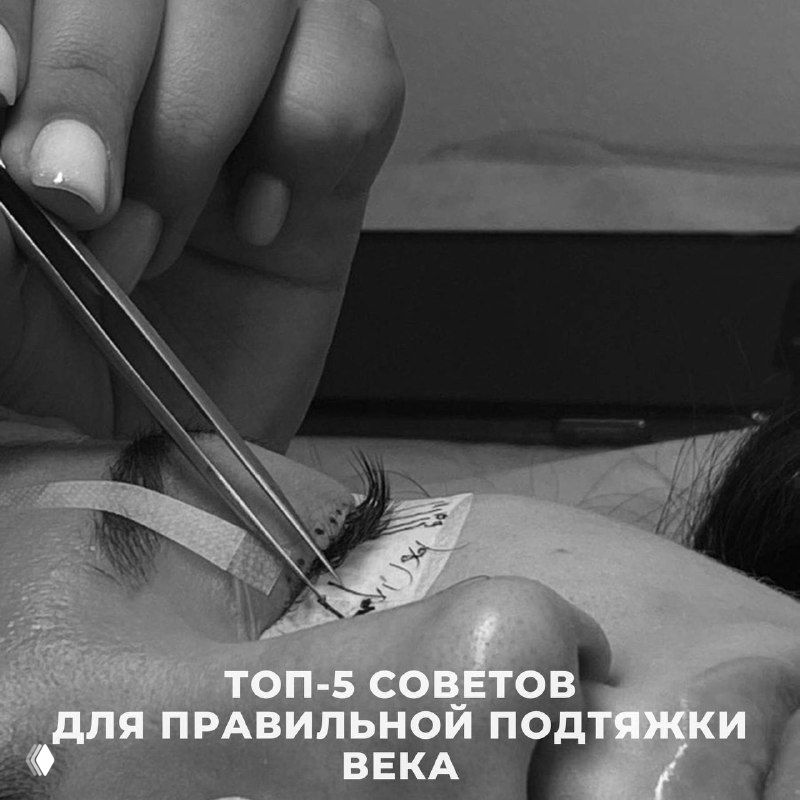 ТОП-5 советов для правильной подтяжки века