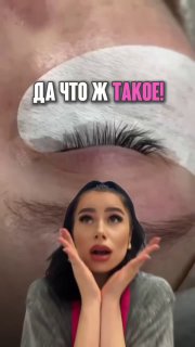 Крупный план глаза с патчем и наращёнными ресницами, сверху стикер с изображением удивлённого лица и подписью «ДА ЧТО Ж ТАКОЕ!»