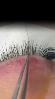 Крупный план век при процедуре наращивания ресниц: пинцет отделяет натуральные ресницы, видна лента и покраснение кожи в рабочей зоне.