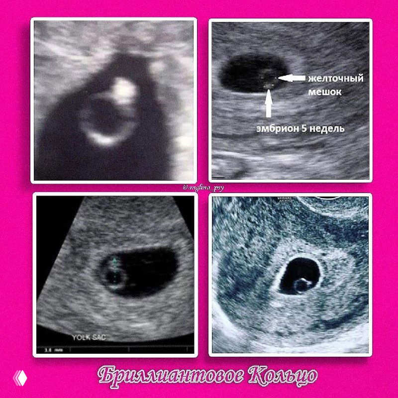 💍 Лучшие друзья девушек - это бриллианты 💍