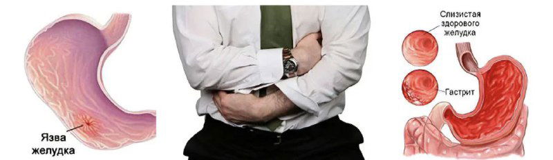 Когда тело кричит: как эмоции влияют на ЖКТ