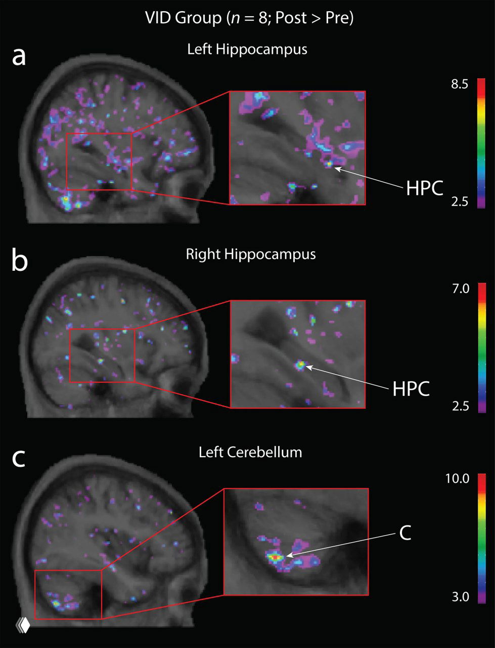 Как видеоигры могут влиять на мозг пожилых людей
