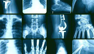 ПЕЧАТЬ ТРАВМЫ