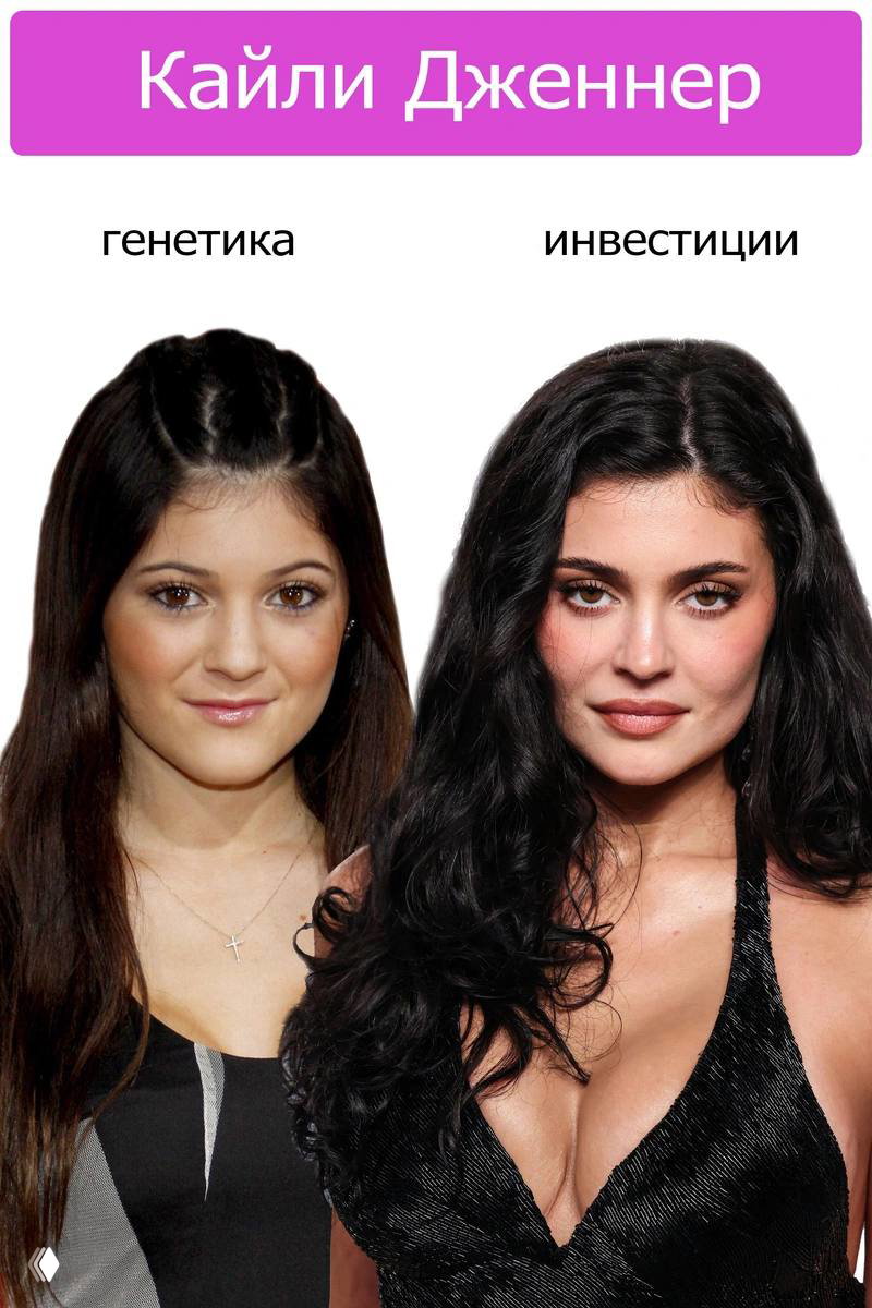 Дело в деньгах или генетике?