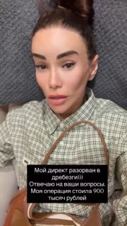 Селфи Айзы в сторис после мини‑лифтинга: лицо без повязки в упомянутом постоперационном виде, макияж и выражение лица блогерши.