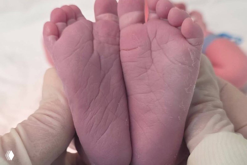 Крупный цветной кадр: стопы новорождённого в руках медицинского персонала, розовый оттенок кожи и деликатная композиция, передающая нежность момента — семейный фрагмент.