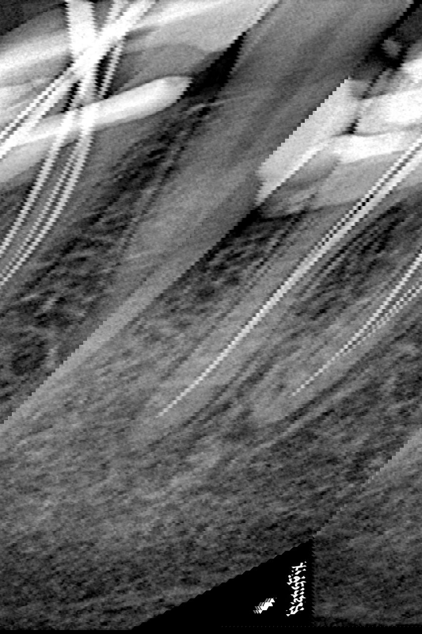 Контрольная рентгенограмма с рабочими инструментами в каналах: отображается байпасирование каналов и положение файлов в процессе лечения.