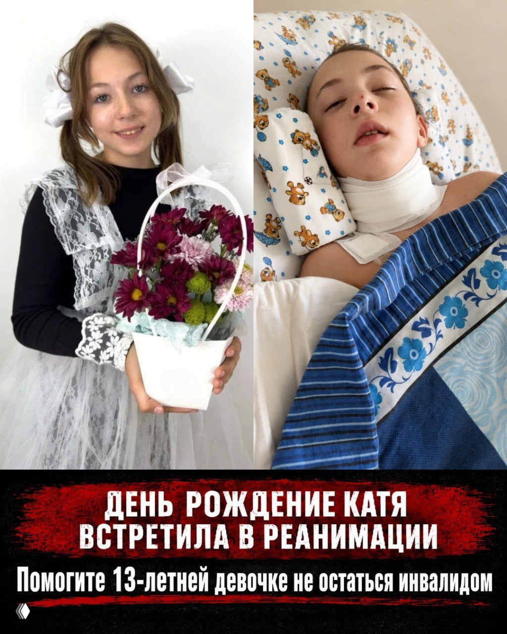 Катя: реабилитация после тяжёлой ЧМТ