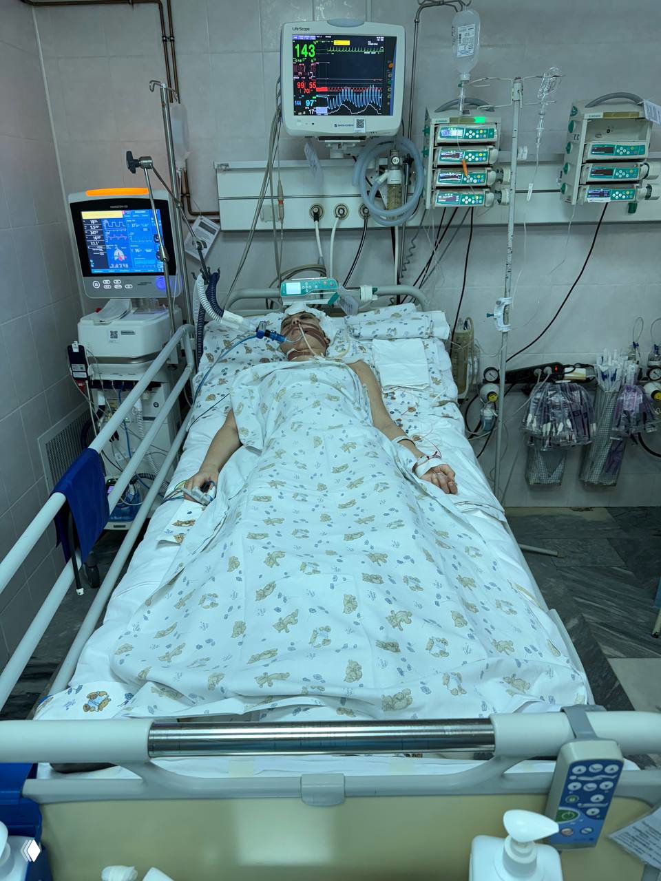Палата интенсивной терапии: Айлина лежит в кровати подключённая к аппаратам жизнеобеспечения и мониторам после операции.