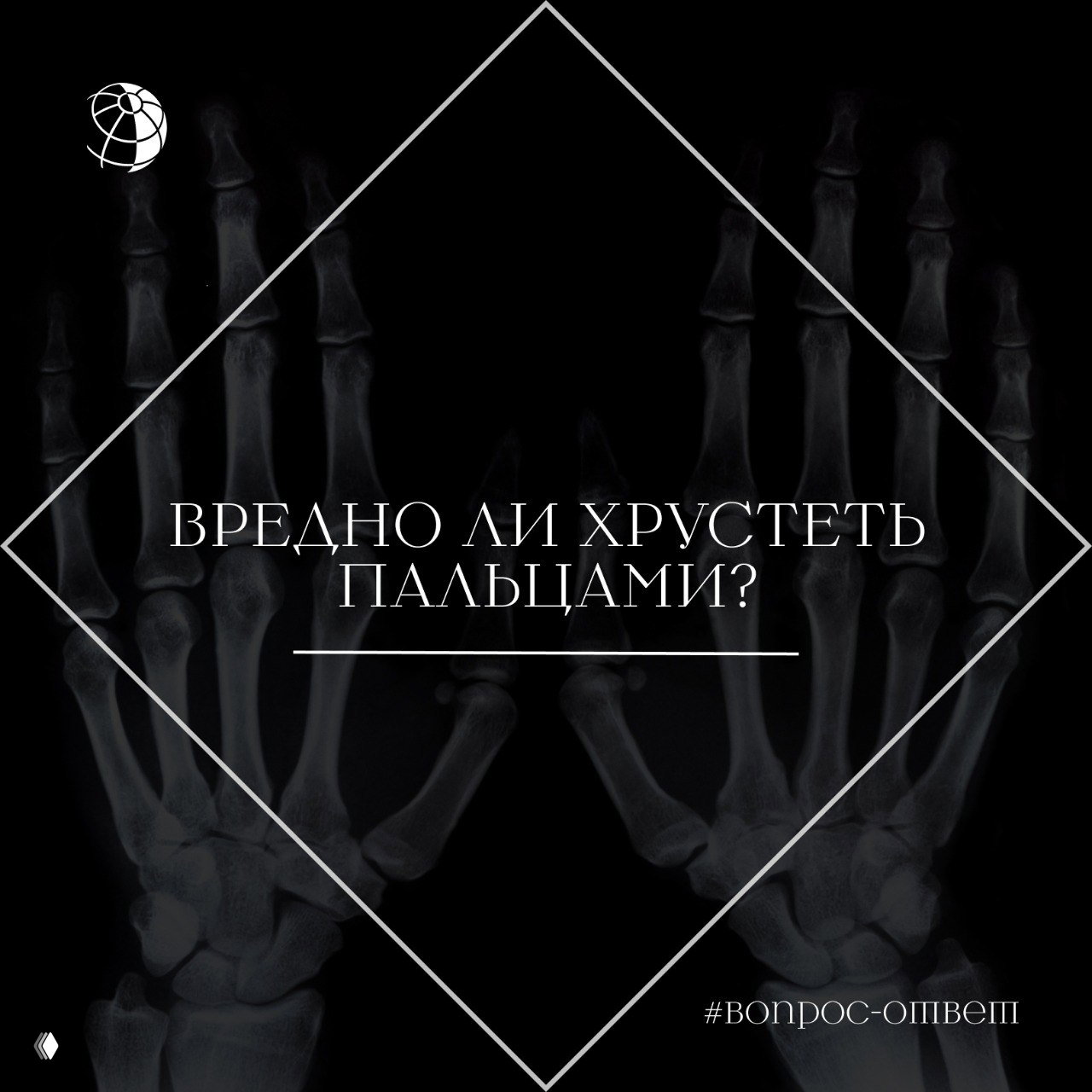 Вредно ли хрустеть пальцами?