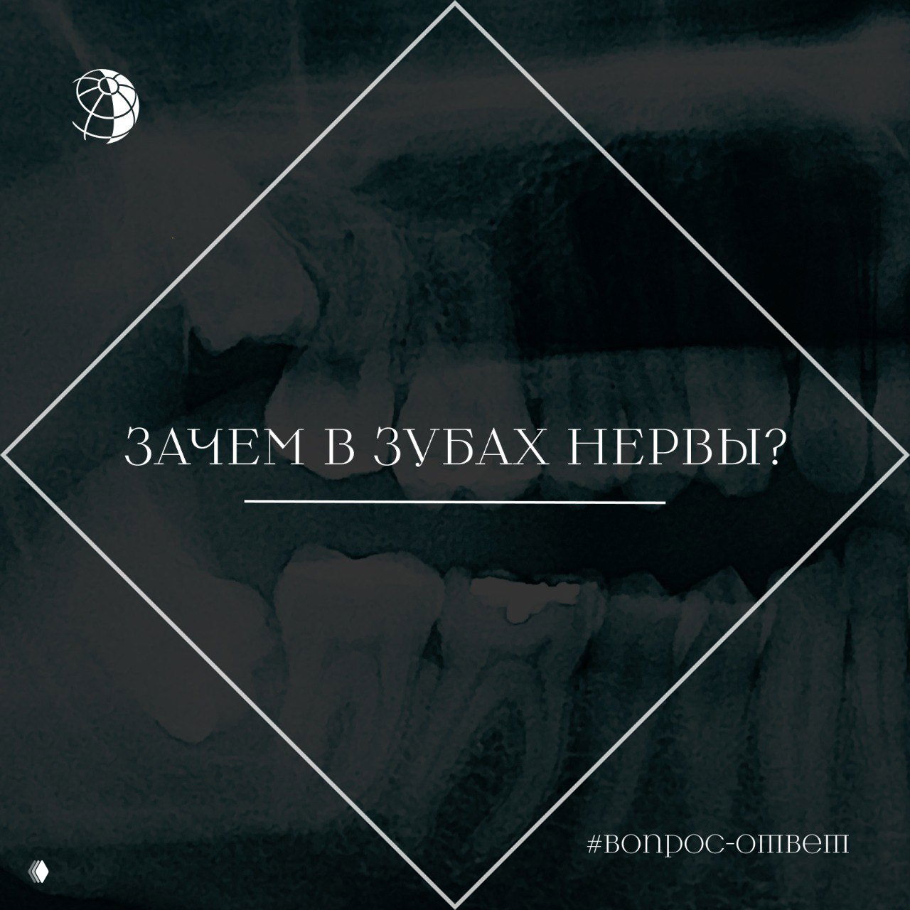 Зачем в зубах нервы?