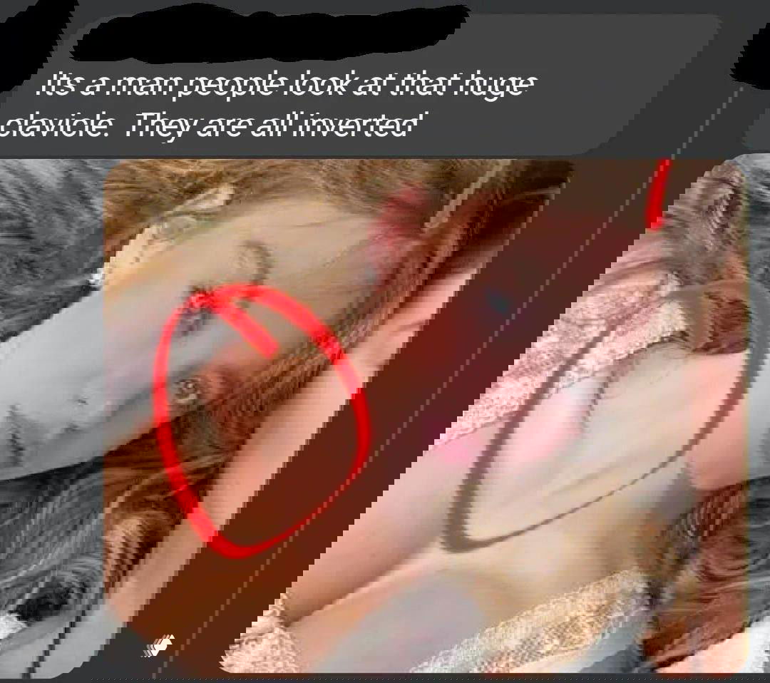 Скриншот комментария с фото, на котором красным кругом выделена область ключицы у женщины, авторы обсуждают форму кости.