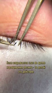 Крупный план века клиента во время наращивания ресниц: пинцет удерживает ресничку у линии роста, виден патч и прилегающая кожа в близком ракурсе.