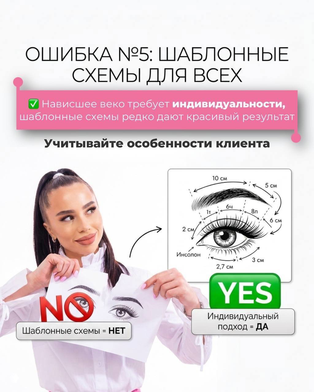 Автор держит примеры шаблонных схем и объясняет, что нависшее веко требует индивидуального подхода, а не универсальных шаблонов