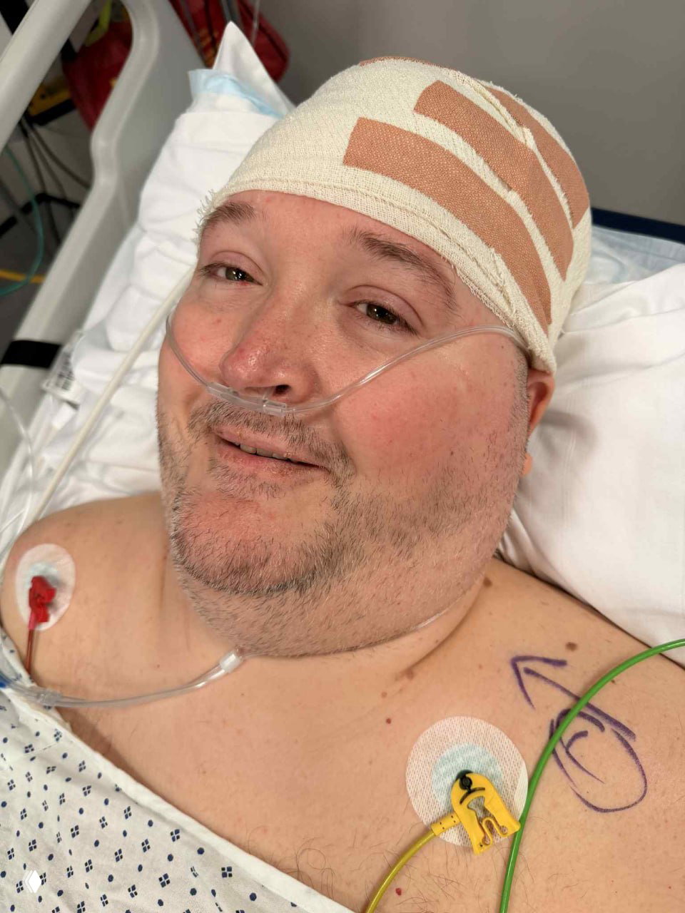Мужчина в больничной постели с повязкой на голове, кислородной трубкой в носу и наклейками/электродами на груди после процедуры