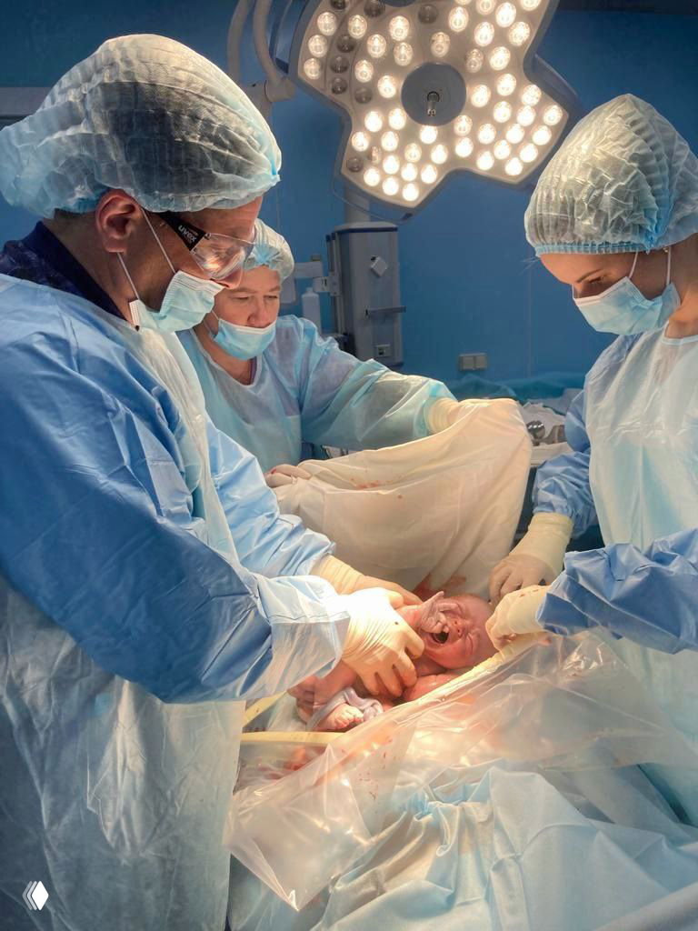Родильная операционная при кесаревом сечении: медицинский персонал в защитных масках и шапочках извлекает новорождённого, видна операционная лампа и стерильные поля.