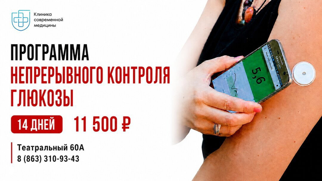 Непрерывный мониторинг глюкозы (НМГ) в Ростове-на-Дону