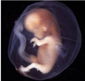 Регрессия в перинатальный период -2