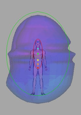Другой снимок ауры пациента: энергетическое поле в виде овала с разноцветными зонами и локальными деформациями вокруг тела.