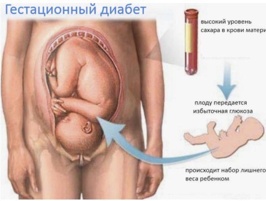 Питание в период беременности и грудного вскармливания