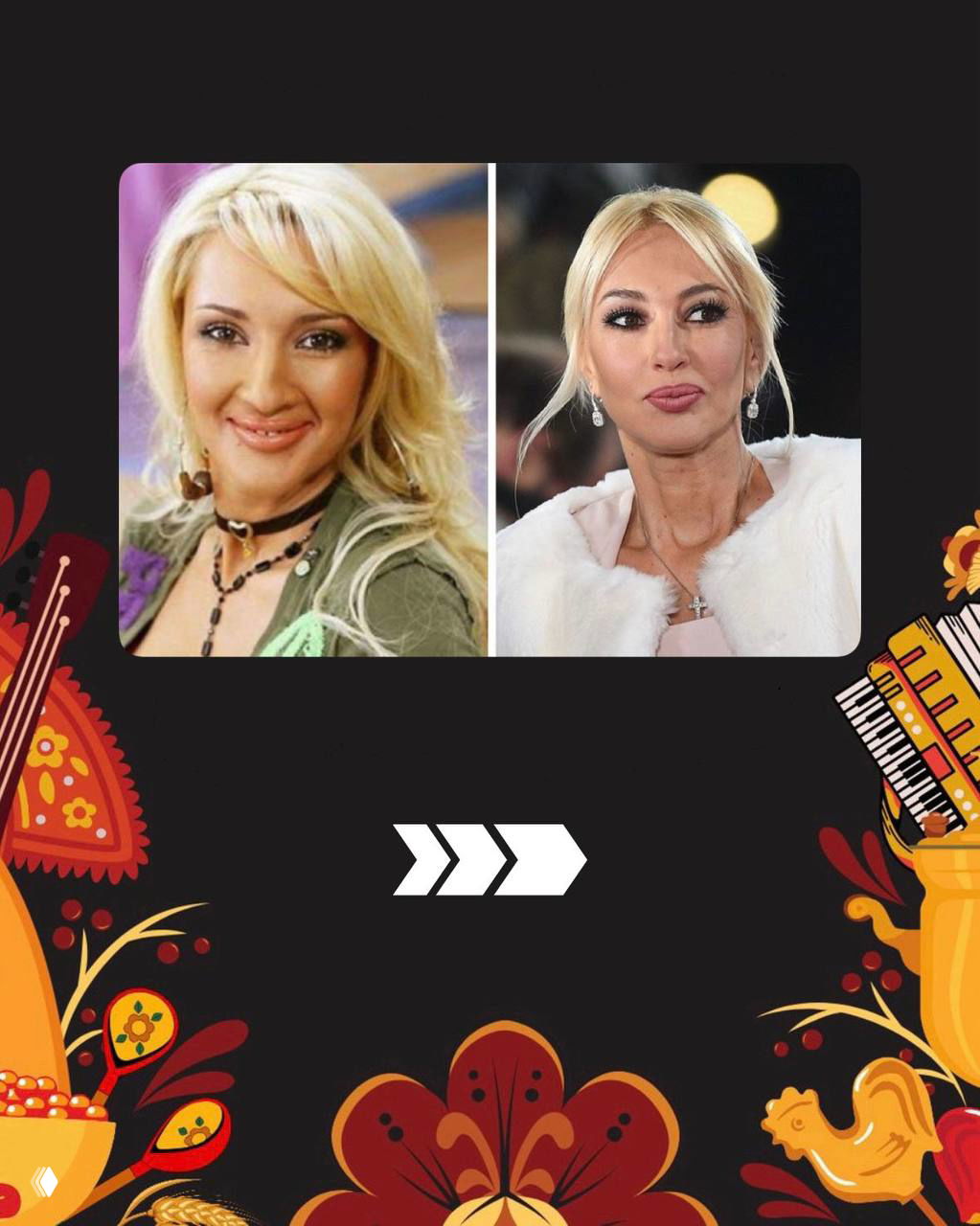 Коллаж с парой фотографий, показывающих вид до вмешательств стиля и после — более гармоничный, ухоженный образ и ровная кожа.