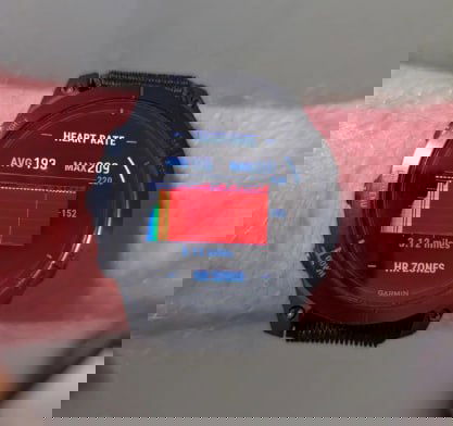 Когда пульсометр врет: 3 повода не паниковать