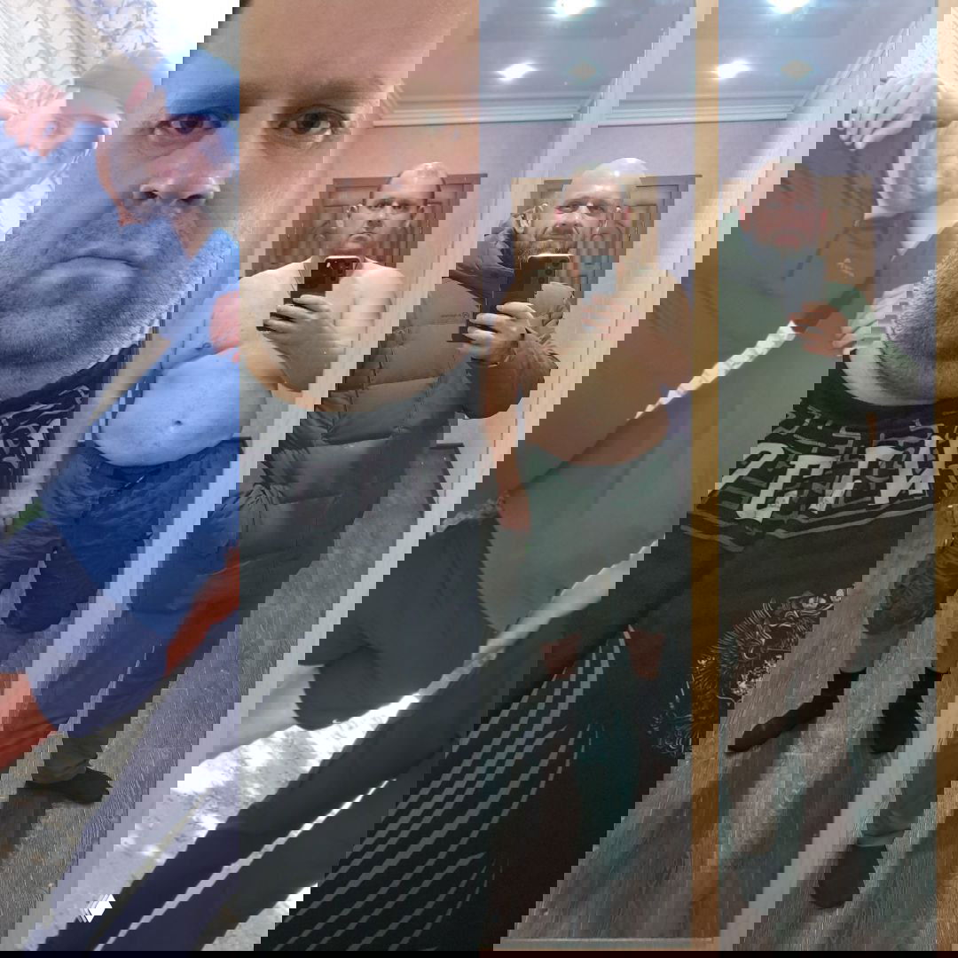 Как за 2 года изменилось моё лицо