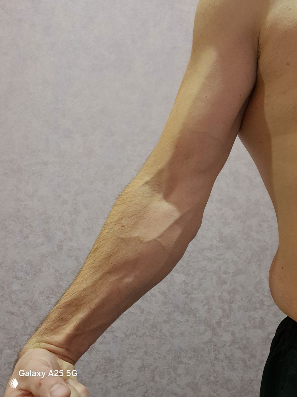 Венозность рук при сушке