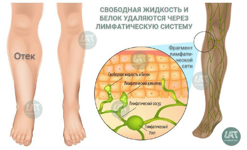 Дренаж — функция лимфатической системы